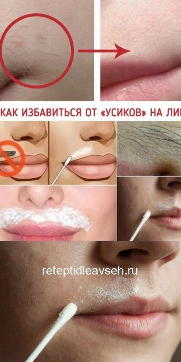 Как избавиться от женских усиков. Средство для убирания усиков. женские усики над верхней губой. как избавиться от усиков у девушки. средства от волос над верхней губой.