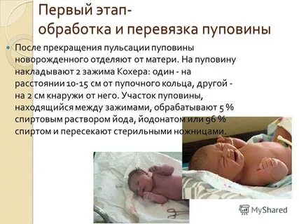 Как обрабатывать новорожденного