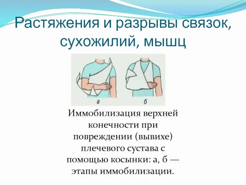 Первая помощь при вывихе плеча. Иммобилизация при вывихе плечевого сустава. растяжения и разрывы иммобилизация. пмп при вывихе плечевого сустава. оказание доврачебной помощи при вывихе плеча.
