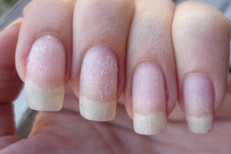 Какие ногти после геля. Какие ногти после геля