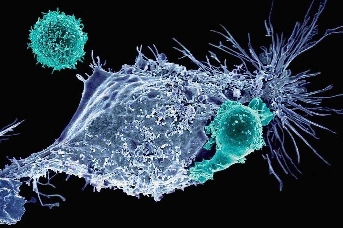 Cancer edition