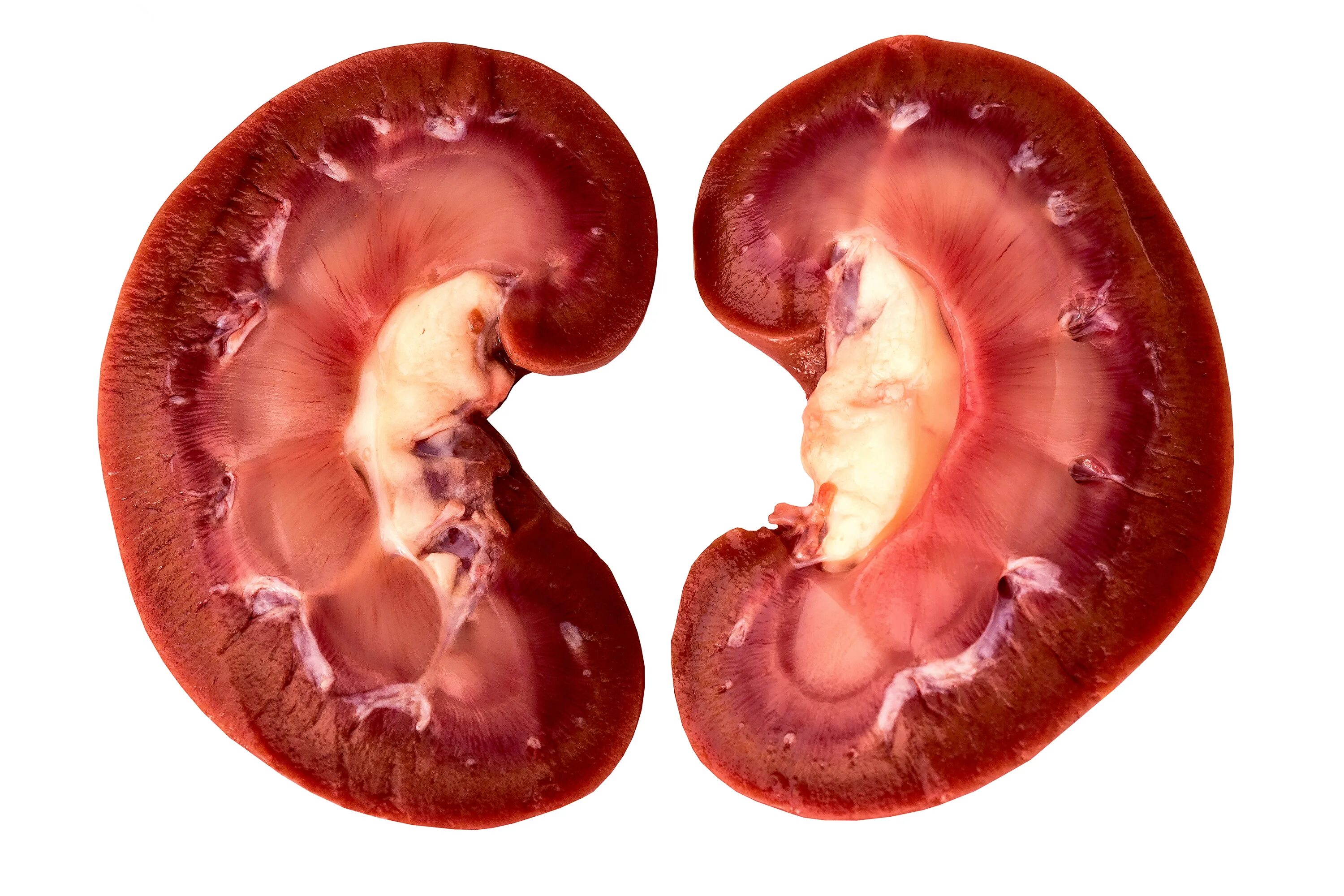 Почка округлой формы. Почки. Почка в разрезе. Человеческая почка в разрезе.