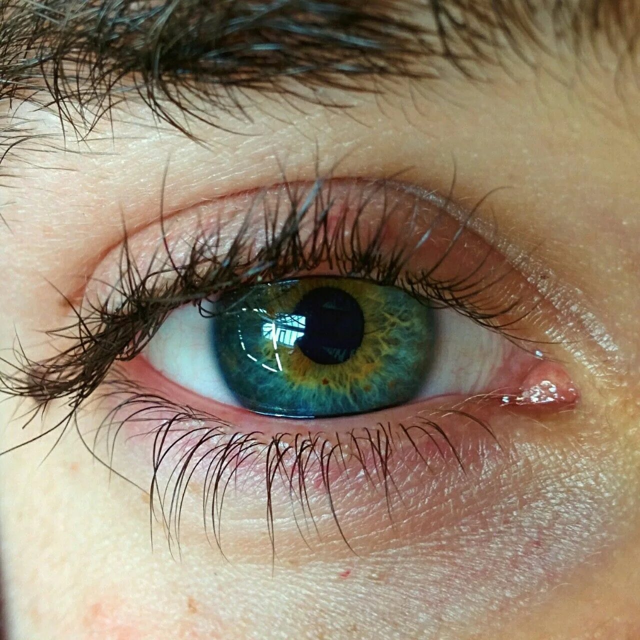 Глаза долу. Болотный цвет глаз гетерохромия. Гетерохромия зеленый и Карий. Гетерохромия серо карие. Центральная гетерохромия зрачок.