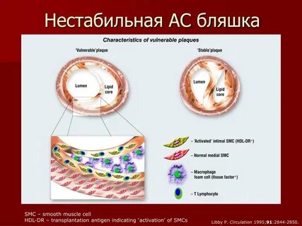 Виды бляшек