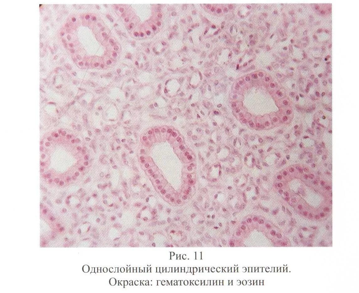Однослойный цилиндрический эпителий рисунок. Цилиндрический эпителий промежуточный. Базально парабазальные клетки в мазке у женщин. Плоский эпителий цитология. Базально парабазальные клетки в мазке у женщин.