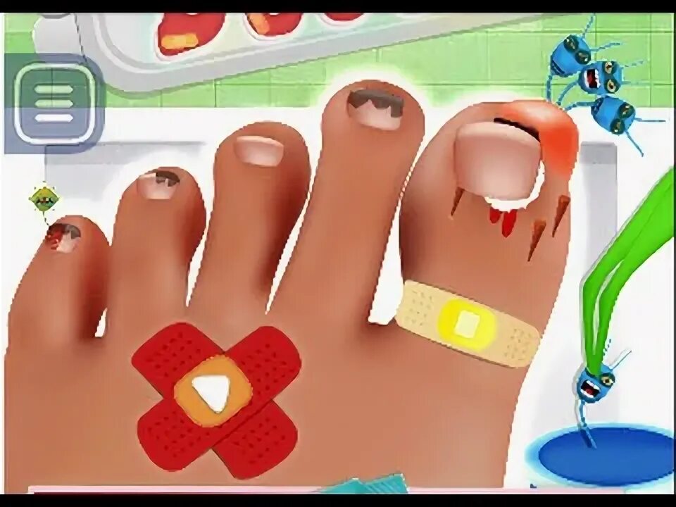 Игра в доктора для детей. Игры нога лечить. Ступни в играх. Ступни в играх. Игры нога лечить.