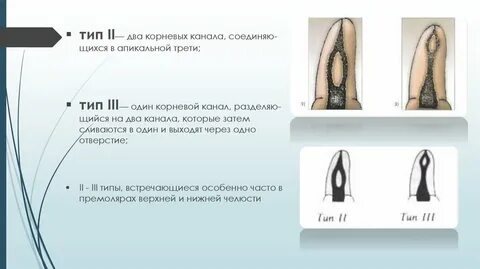 Рабочая длина корневых каналов зуба