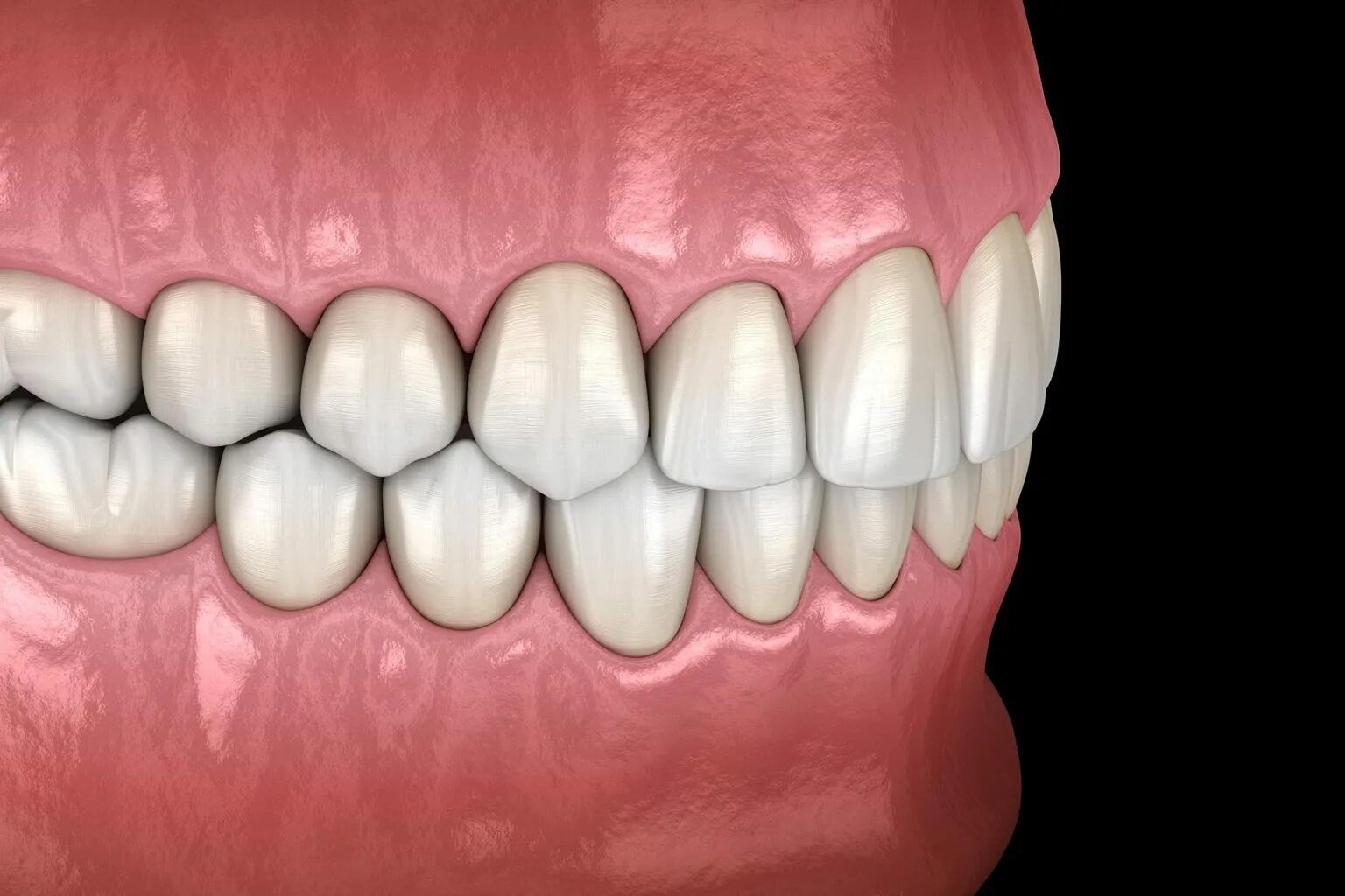 Pin on Dental Care @ Identalhub