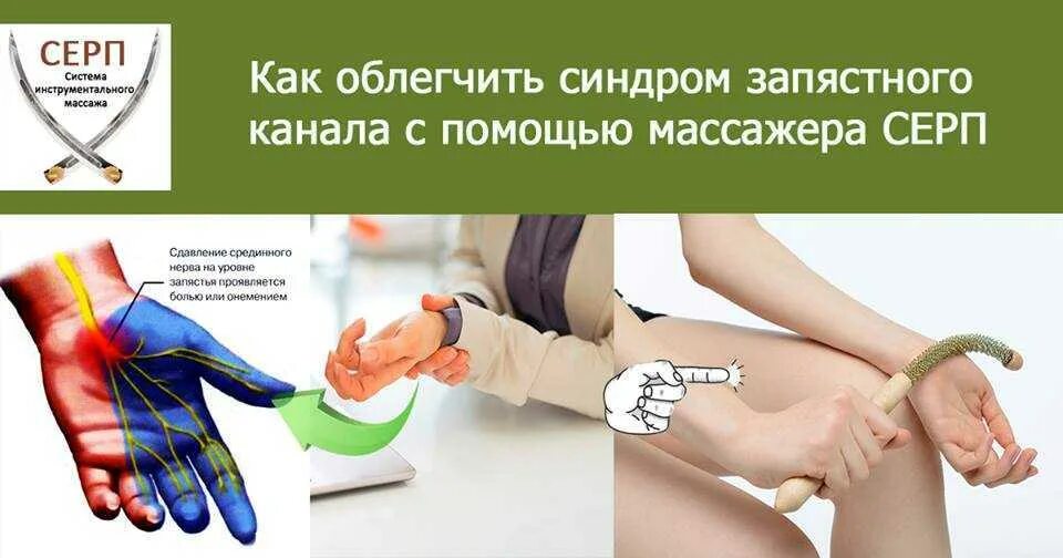 Синдром запястного канала операция. Туннельный синдром запястья. кистевой туннельный синдром. синдром запястного (карпального) канала. туннельный карпальный синдром руки.