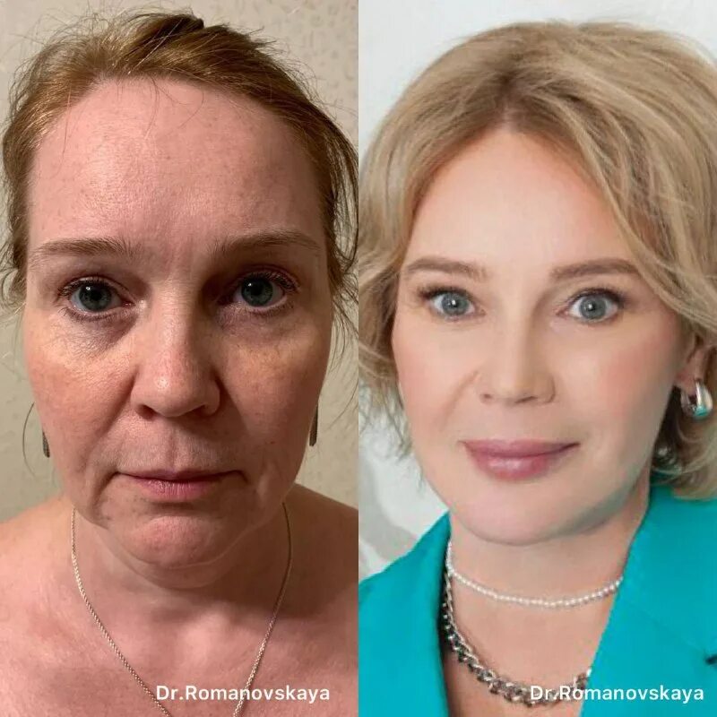 татьяна романовская хирург. романовская татьяна владимировна пластический хирург. романовская татьяна владимировна.