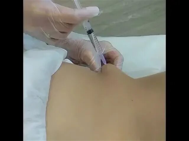 Можно ли колоть липолитики