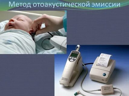 Отоакустическая эмиссия