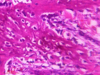 Myositis латынь