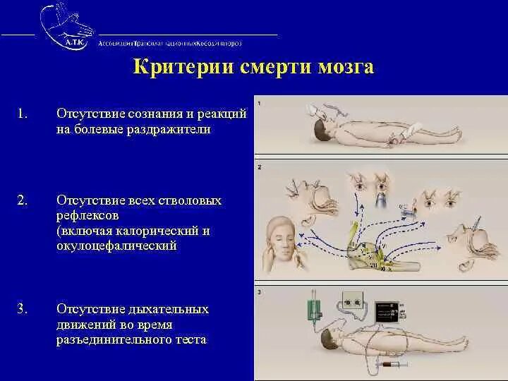 Поведение умирающего человека