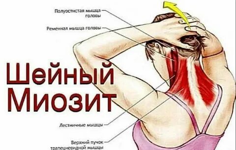 Myositis латынь