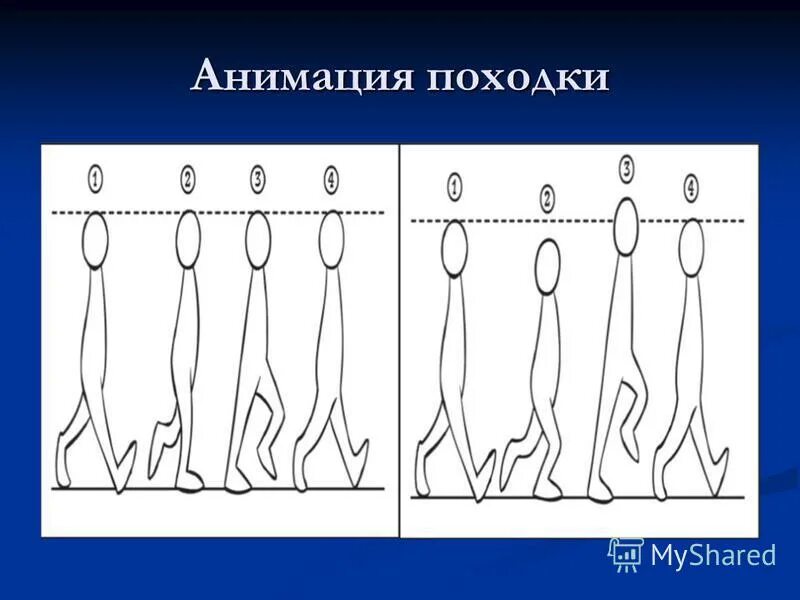 исследование функции вестибулярного анализатора. походка классификация. походка адиадохокинез. фланговая походка проба. лабиринтная атаксия.
