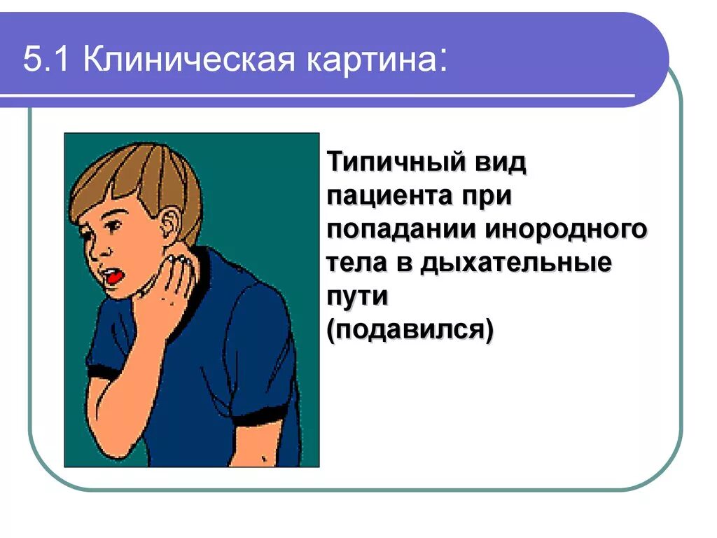 Попадание инородного тела в дыхательные пути. При попадании инородного тела в дыхательные пути. ПМП при попадании инородного тела в дыхательные пути. Инородные тела верхних дыхательных путей.