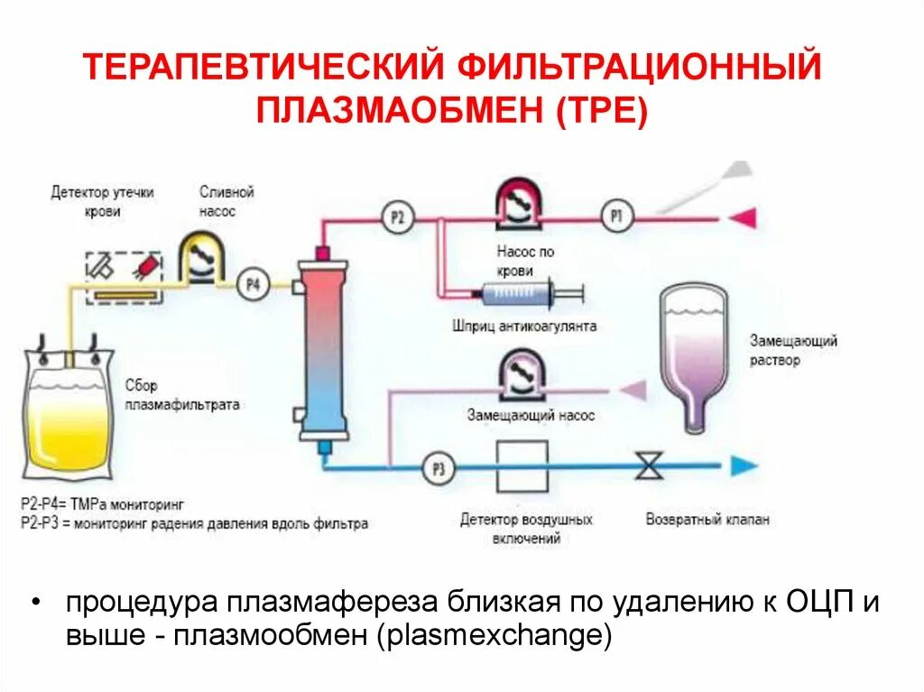 Гемофорез что это. Схема проведения плазмафереза. Плазмообмен. Плазмаферез схема проведения. Схема плазмообмена.