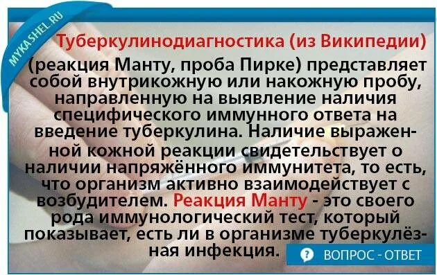 Кашель насморк манту. Реакция манту при простуде. Манту ребенку при насморке. Можно делать манту когда сопли.