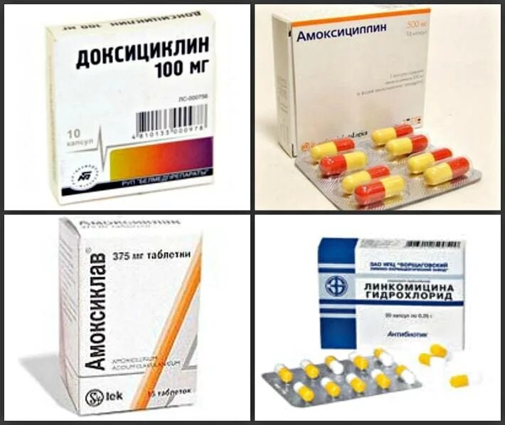 Лучший антибиотик при флюсе зуба у взрослого. Антибиотик от флюса. таблетки от флюса. антибиотик от флюса зубного. антибиотики при восполнения десен.