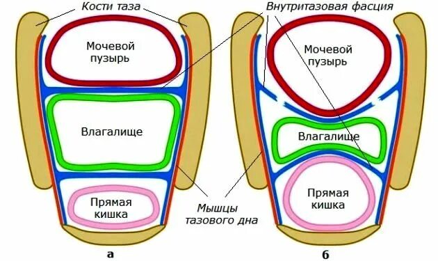 Внутритазовая фасция. Средняя глубина влагалища. Глубина влагалища в 14 лет. Разрыв Лобково шеечной фасции причины.