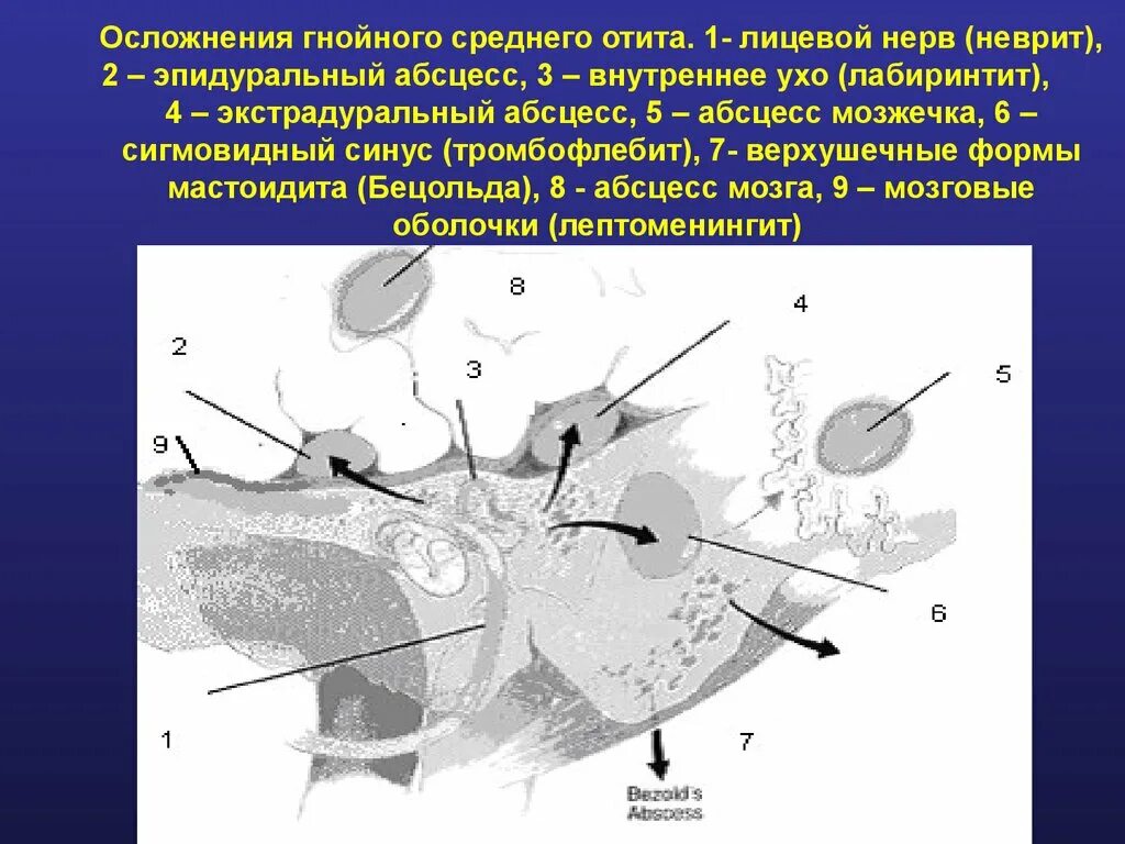 Канал лицевого нерва в барабанной полости. Лицевой нерв в барабанной полости. Лицевой нерв и среднее ухо.