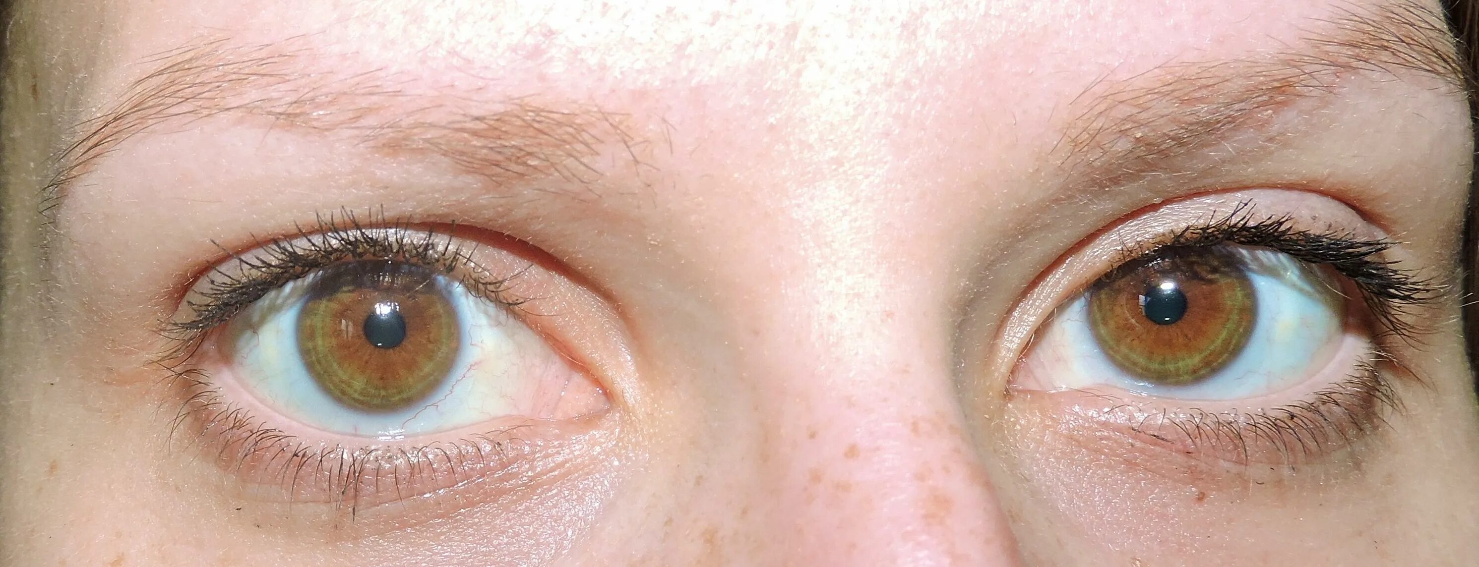 Цвет глаз человека определяется пигментацией. Центральная гетерохромия карих глаз. Центральная гетерохромия глаз Карий и зеленый. Центральная гетерохромия карте глпща. Гетерохромия Радужки глаза Карий зеленый.