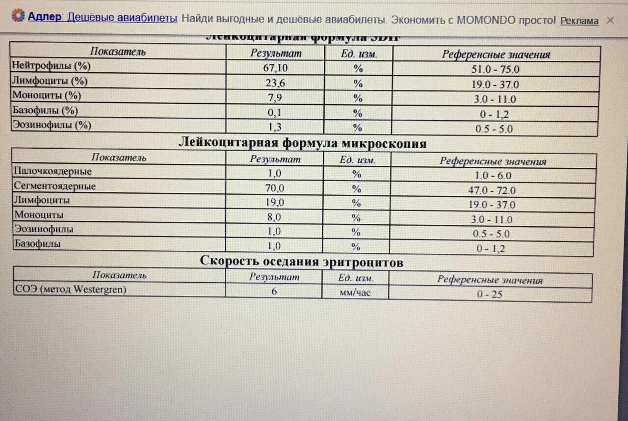 Ифа какой анализ. Иммуноферментный анализ норма. ИФА анализ крови расшифровка. Кровь на ИФА расшифровка анализа крови. ИФА анализ норма.