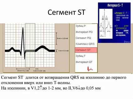 Тип сегмента