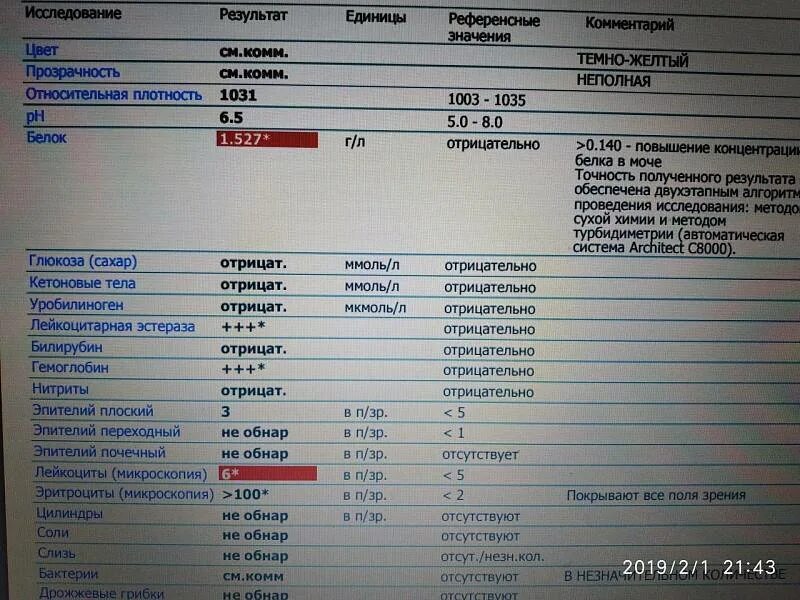 Когда в моче определяют мезобилиноген уробилиноген. Уробилиноген в моче.