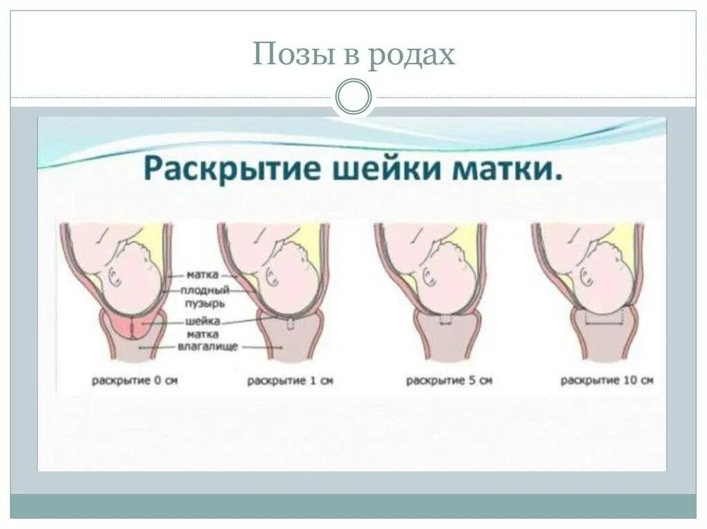 Позы для раскрытия шейки матки. Упражнения для раскрытия шейки матки перед родами. Позы для раскрытия шейки матки перед родами.