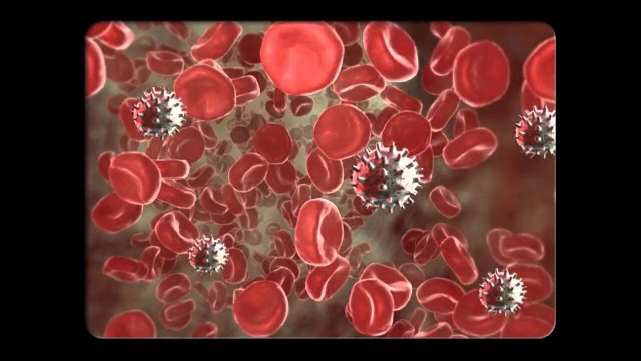 Гломерулонефрит эритроциты
