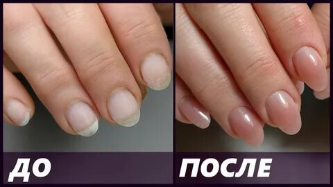 Можно ли полигелем укреплять ногти