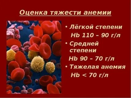 Анемией 3