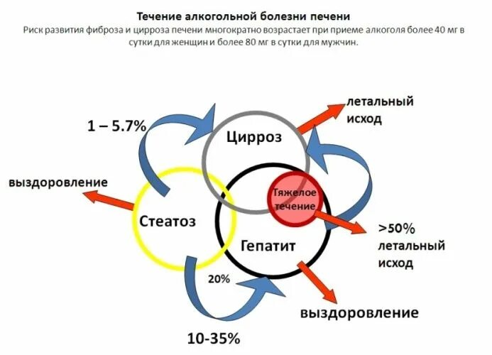 Алкогольная болезнь печени. Цирроз симптомы у мужчин алкоголиков. Цирроз симптомы у мужчин алкоголиков. Цирроз симптомы у мужчин алкоголиков. Цирроз симптомы у мужчин алкоголиков.