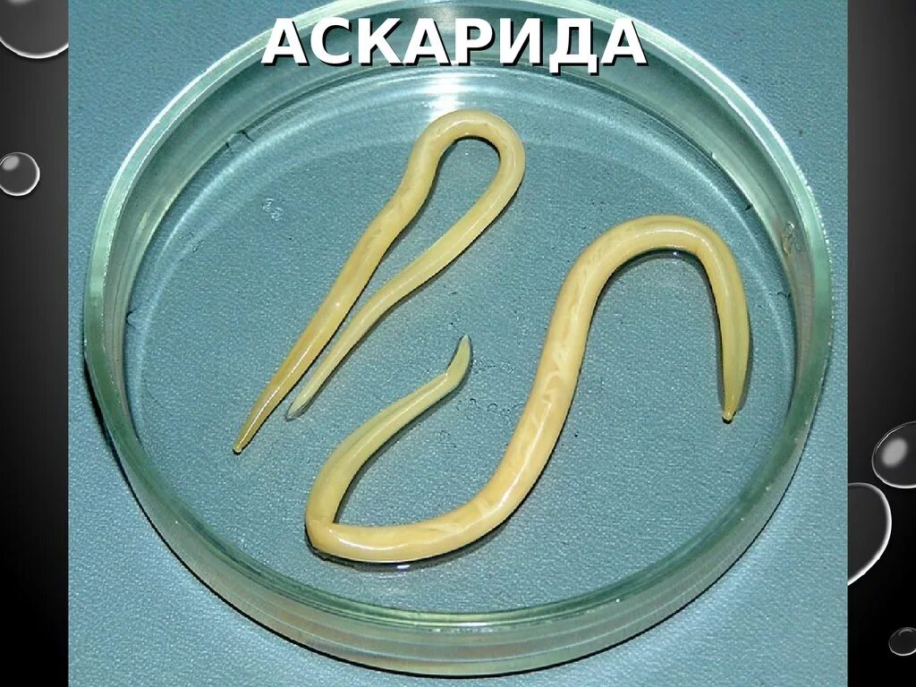 глисты аскариды у ребенка