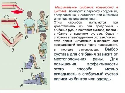 К остановке кровотечения приводит