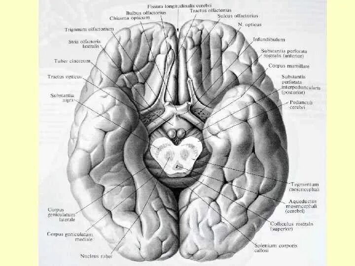Нижняя поверхность головного мозга анатомия. Нижняя поверхность мозга извилины анатомия. Sulcus olfactorius анатомия. Нижняя поверхность головного мозга Сагиттальный. Мозг снизу