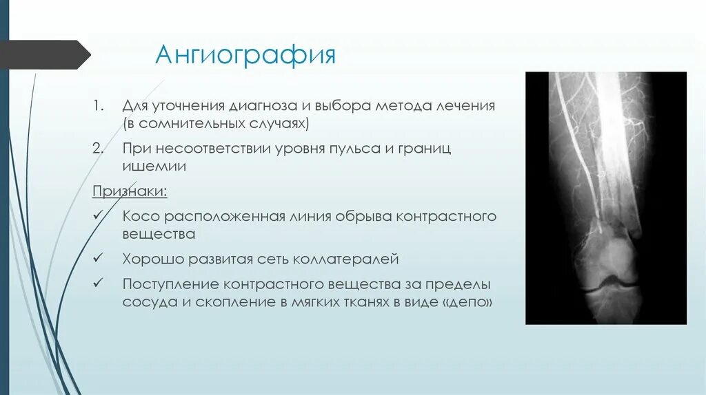 Уточненный диагноз это. Ангиография. Ангиография бедренной артерии. Ангиография контрастное вещество. Ангиография по дос Сантос.