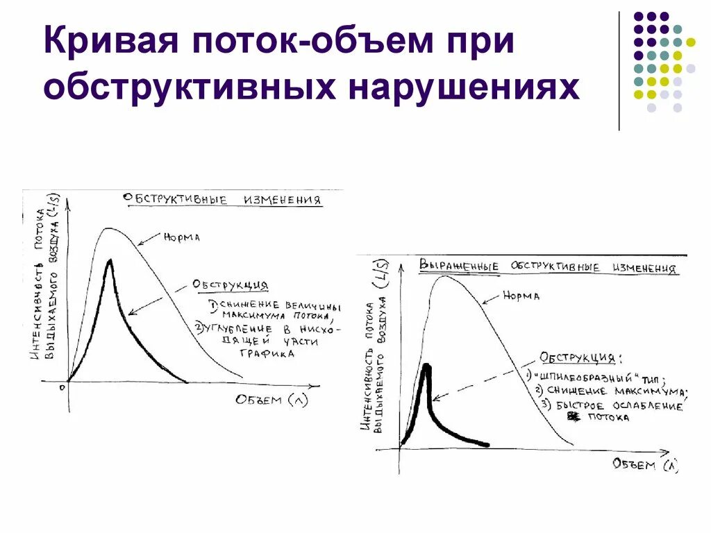 Спирограмма кривая поток объем. Обструктивный Тип нарушения дыхания спирометрия. Обструктивный Тип нарушения дыхания спирография. Обструктивный Тип нарушения ФВД. Нарушение легких по обструктивному типу