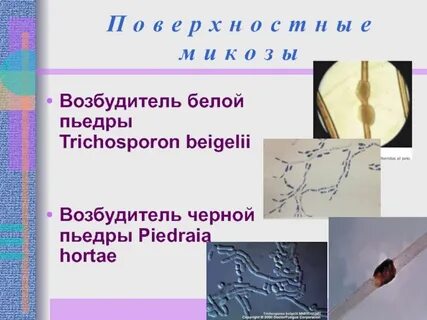 Черный возбудитель