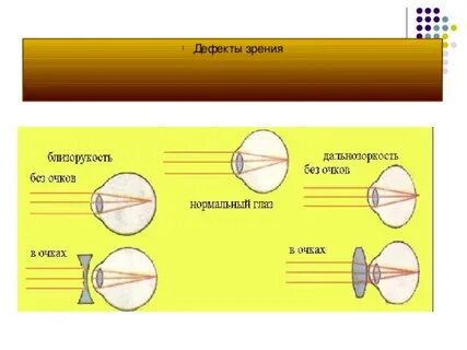 Определение близорукости и дальнозоркости