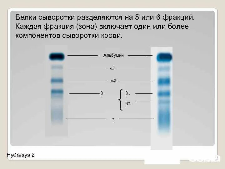 5 фракций белков. Фракции α1 и α2-глобулинов. 5 фракций белков. Белковые фракции. 5 фракций белков.