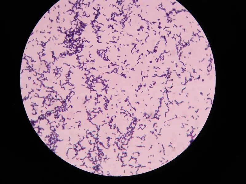 Streptococcus мазок