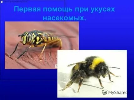 Помощь при укусах насекомых