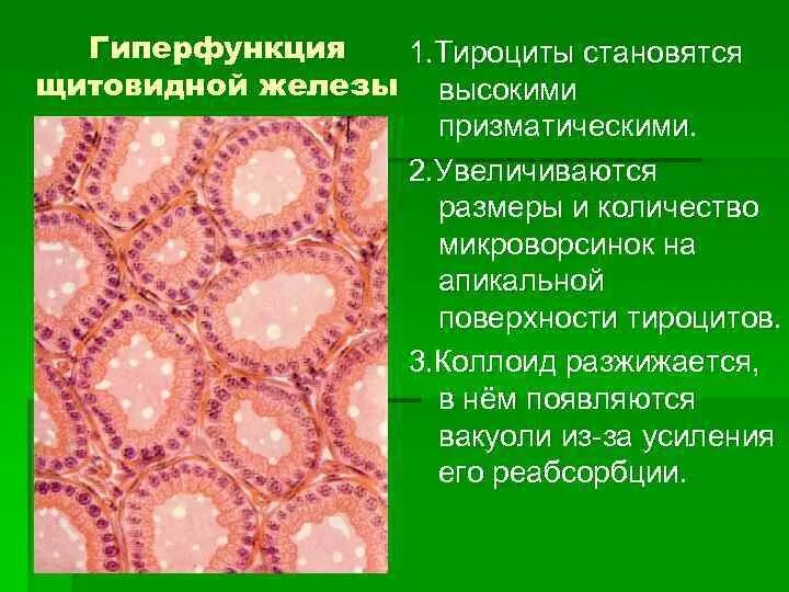 Тироциты щитовидной железы гистология. Тироциты фолликулярные клетки щитовидной железы. Фолликул щитовидной железы препарат. Щитовидная железа фолликул тироциты. Фолликул тироцита