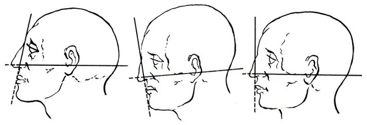 Теменные косточки. Лицевой угол кампера. Угол головы. Лицевой угол. Угол головы.