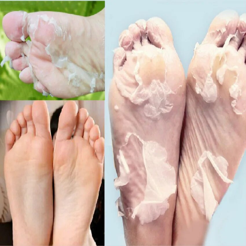 Носка отшелушивать педикюр. Peeling foot Mask педикюрные носочки. Пилинг носочки для педикюра foot Care Mask. Китайские носочки для педикюра отшелушивающие.