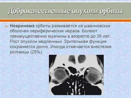 Доброкачественная опухоль тест