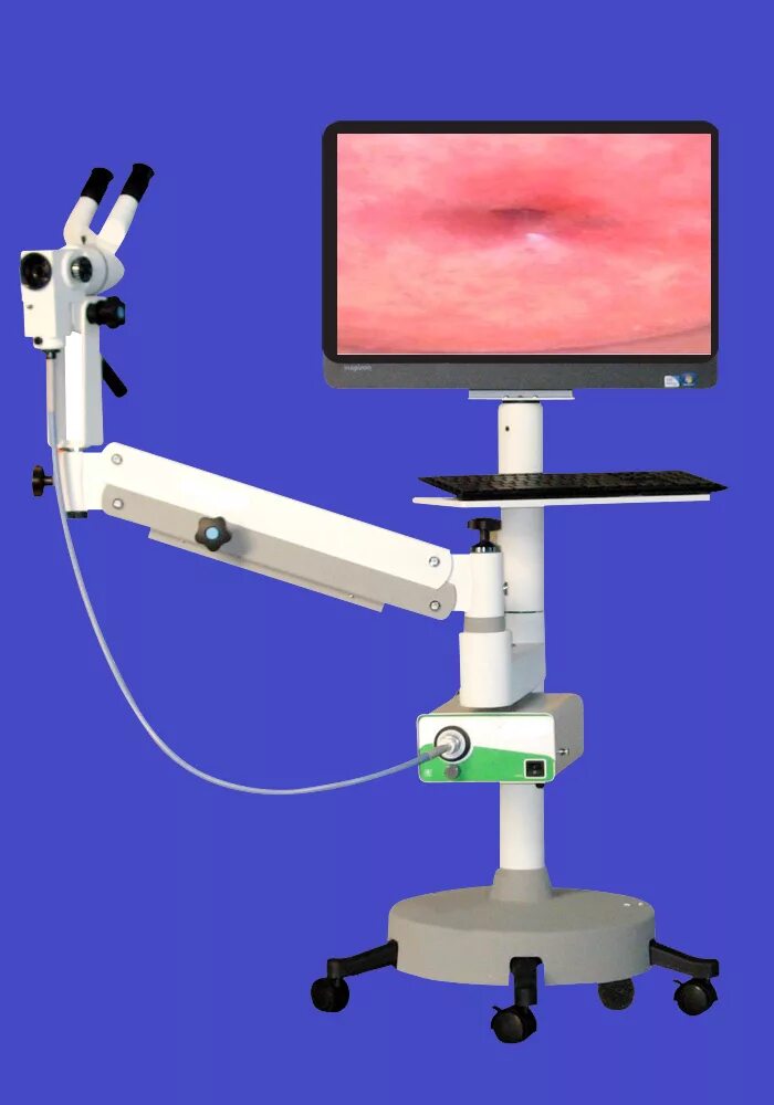 Кольпоскоп кольпоскопия. Видеокольпоскопия шейки матки. Кольпоскоп SLV-101. Кольпоскопия аппарат.